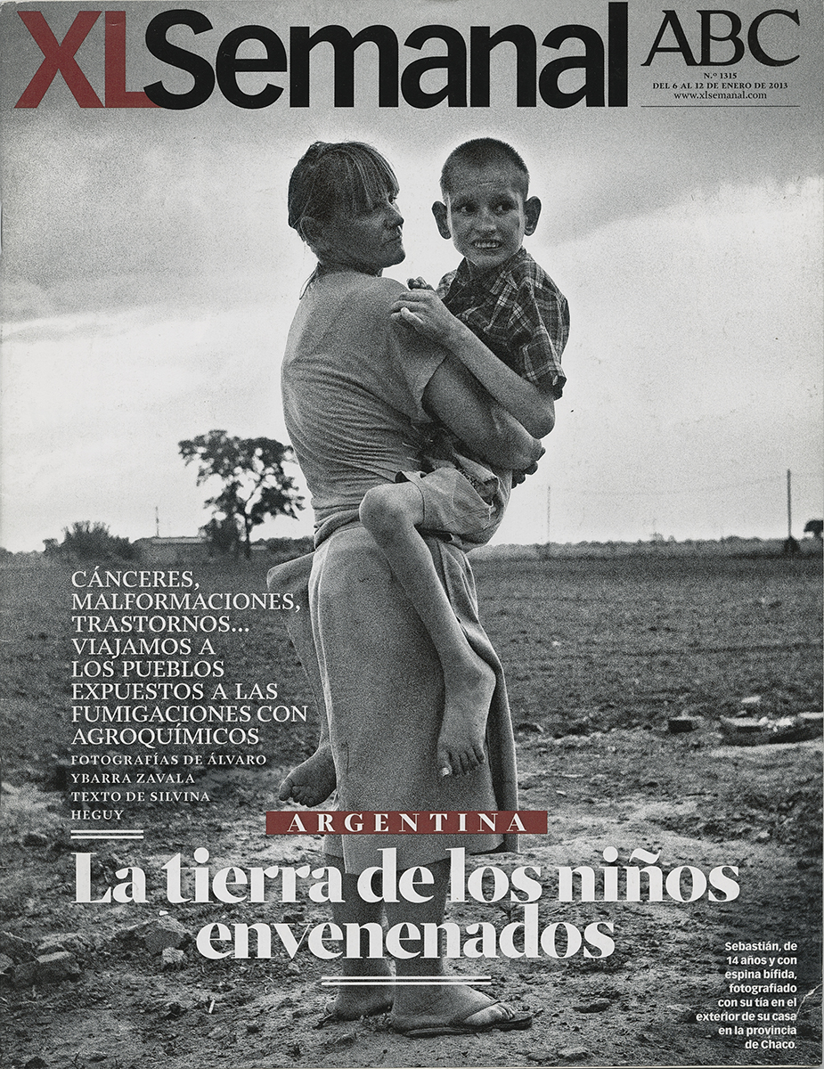 Argentina, la tierra de los niños envenenados por agroquímicos