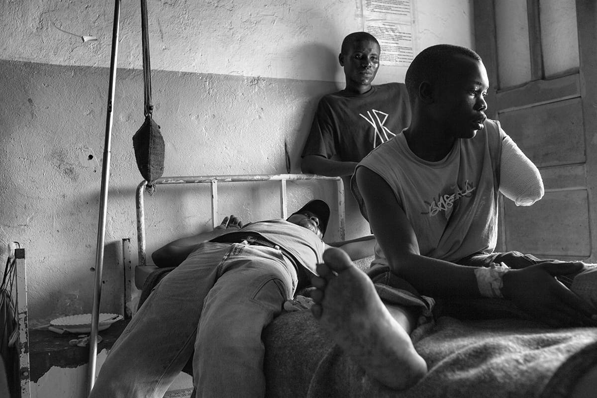 A patient with an amputated arm sitting on a bed inside the hospital in Goma, North Kivu.