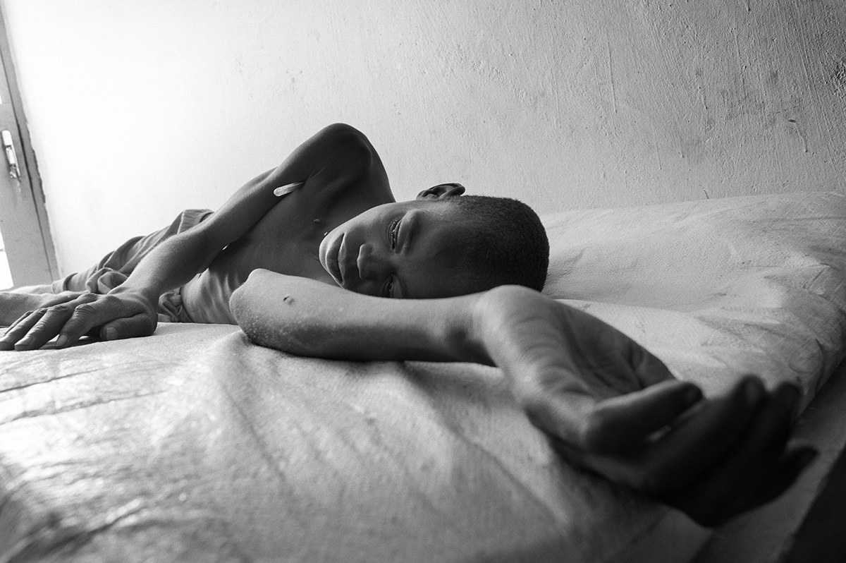 Emaciated boy resting on a hospital mattress in a health centre in Darfur, Sudan.