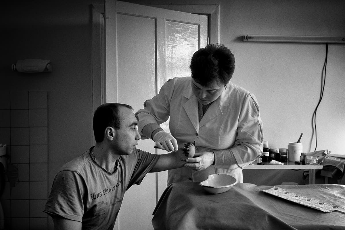 Alexander, who lost his left arm to shelling, during his daily treatment at the hospital in Donetsk.